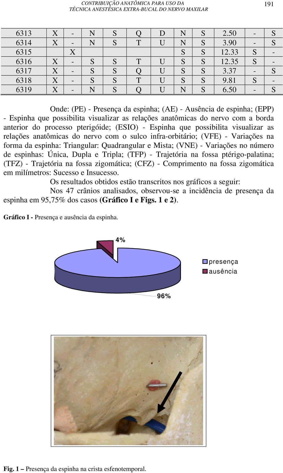 Espinha que possibilita visualizar as relações anatômicas do nervo com o sulco infra-orbitário; (VFE) - Variações na forma da espinha: Triangular: Quadrangular e Mista; (VNE) - Variações no número de