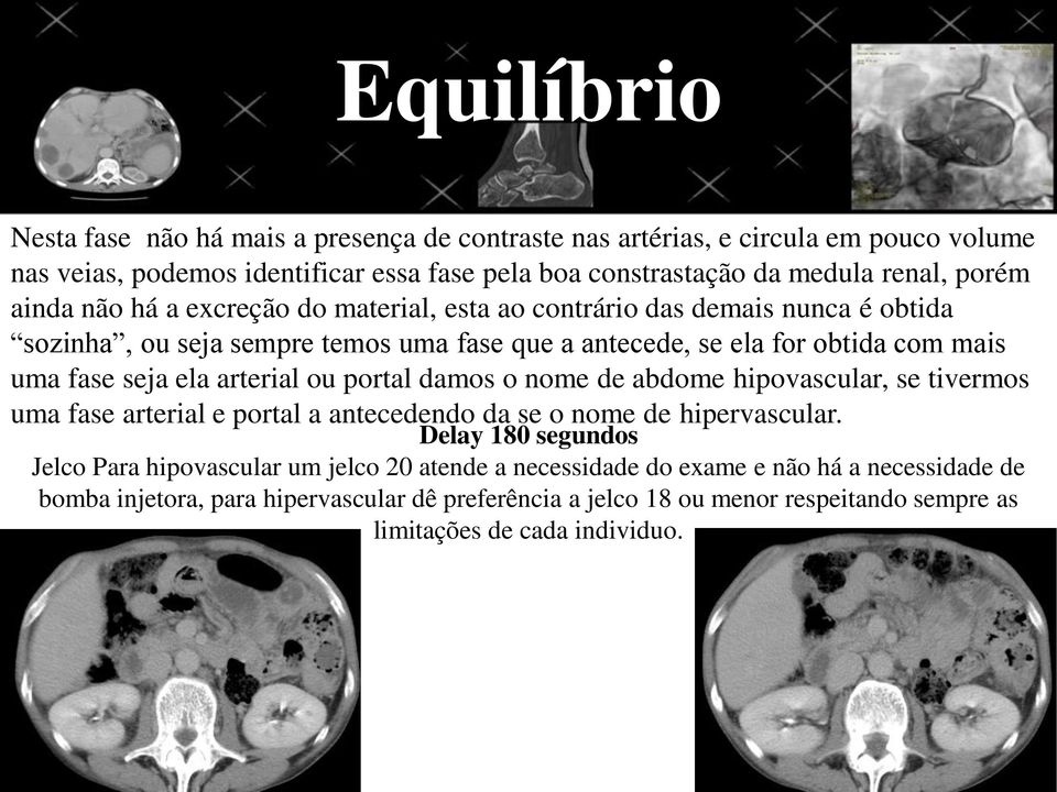 arterial ou portal damos o nome de abdome hipovascular, se tivermos uma fase arterial e portal a antecedendo da se o nome de hipervascular.