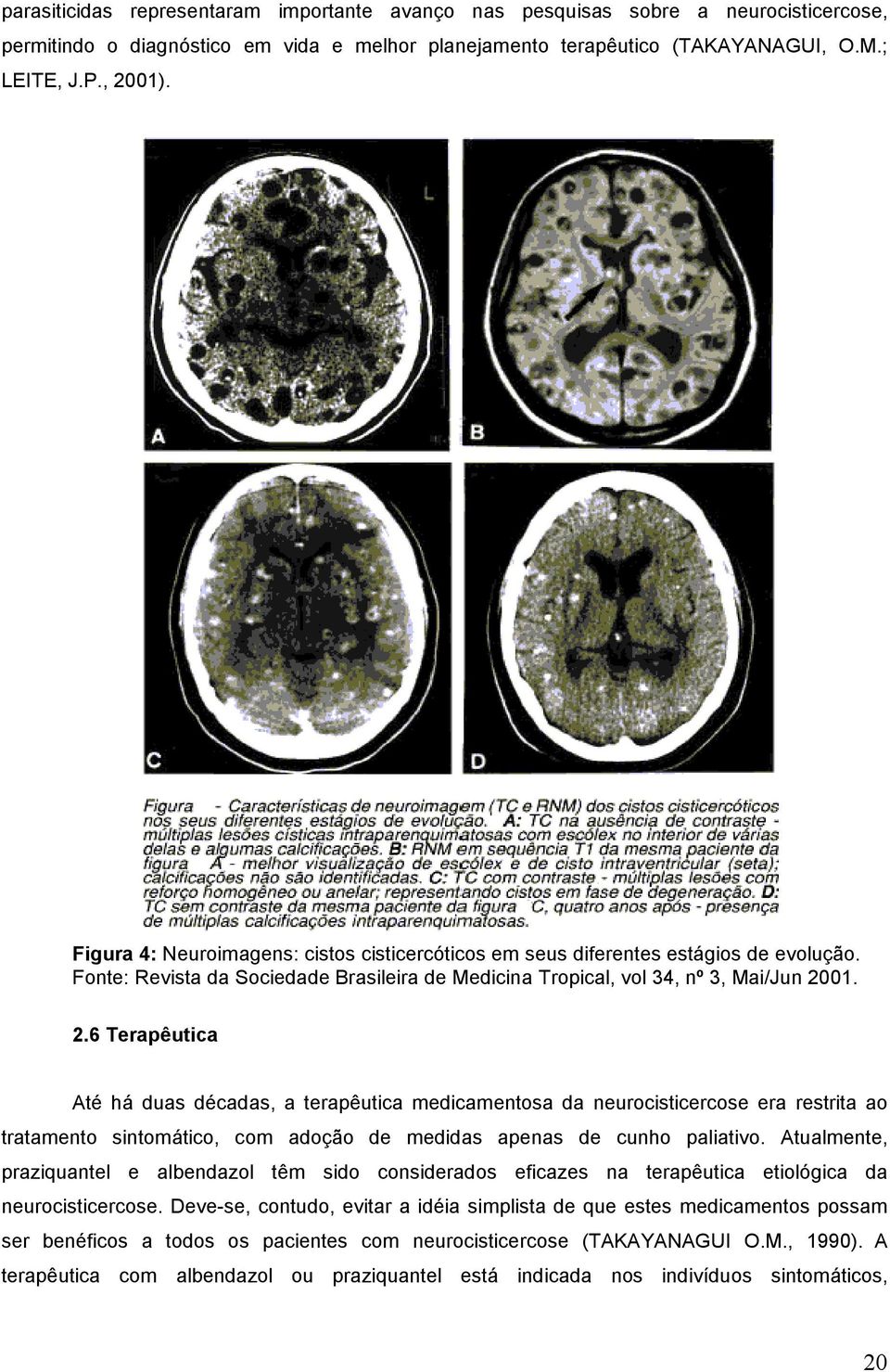 01. 2.6 Terapêutica Até há duas décadas, a terapêutica medicamentosa da neurocisticercose era restrita ao tratamento sintomático, com adoção de medidas apenas de cunho paliativo.