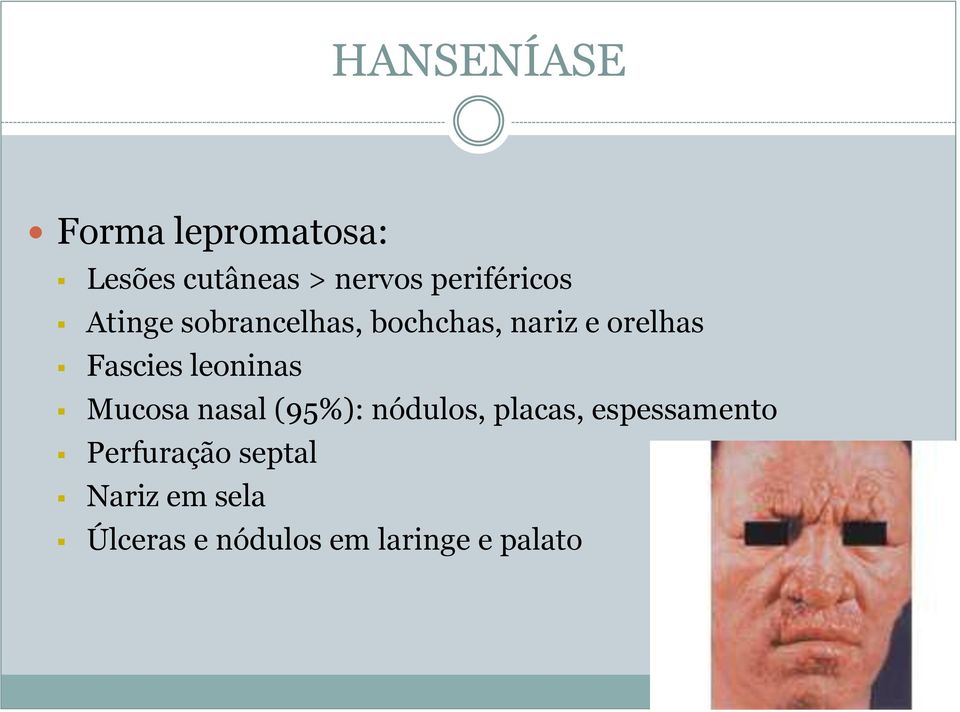 Fascies leoninas Mucosa nasal (95%): nódulos, placas,