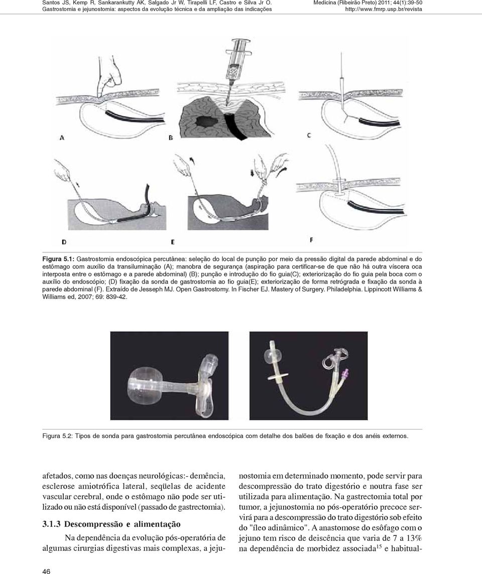 para certificar-se de que não há outra víscera oca interposta entre o estômago e a parede abdominal) (B); punção e introdução do fio guia(c); exteriorização do fio guia pela boca com o auxílio do