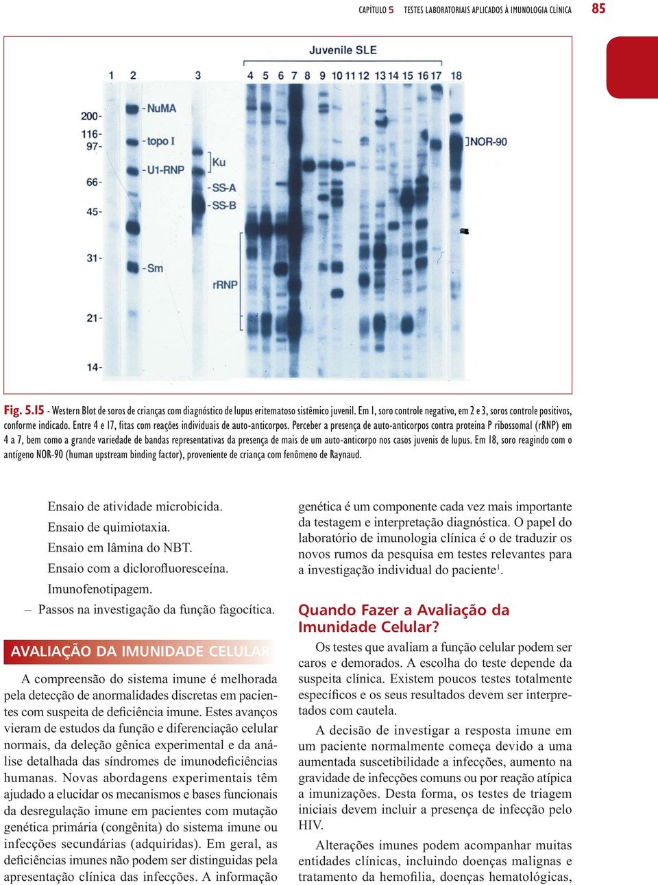 Perceber a presença de auto-anticorpos contra proteina P ribossomal (rrnp) em 4 a 7, bem como a grande variedade de bandas representativas da presença de mais de um auto-anticorpo nos casos juvenis