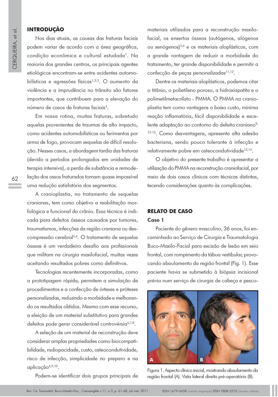 O aumento da violência e a imprudência no trânsito são fatores importantes, que contribuem para a elevação do número de casos de fraturas faciais 4.