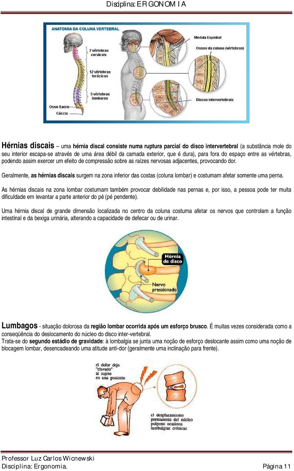 Geralmente, as hérnias discais surgem na zona inferior das costas (coluna lombar) e costumam afetar somente uma perna.