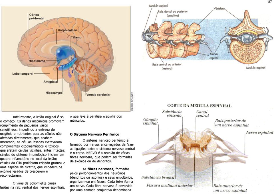 extravasam componentes citoplasmáticos e tóxicos, que afetam células vizinhas, antes intactas; células do sistema imunológico iniciam um quadro inflamatório no local da lesão; células da Glia