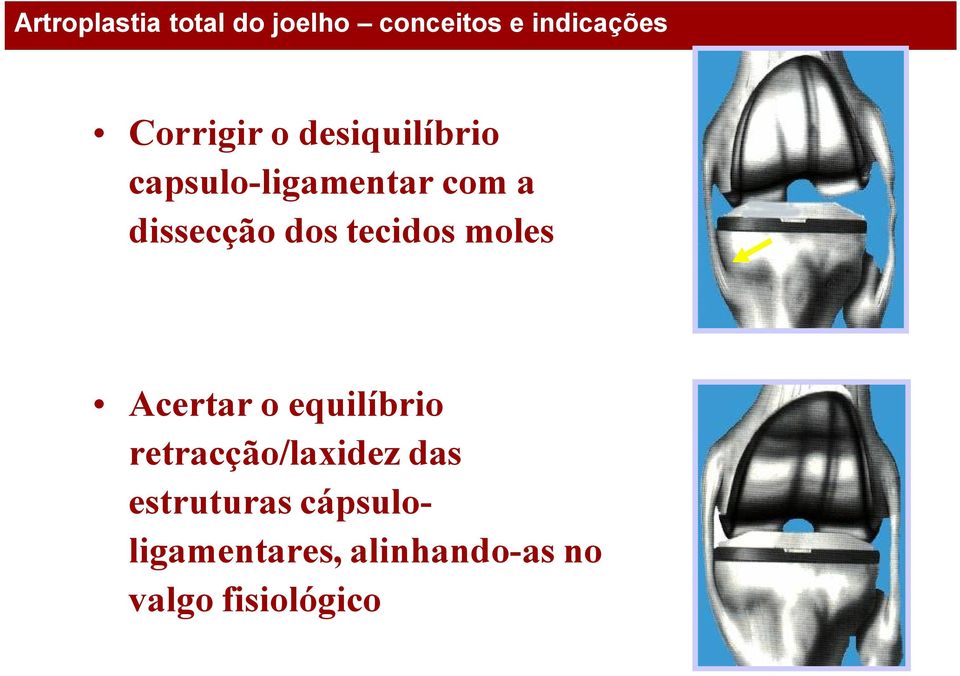 equilíbrio retracção/laxidez das estruturas