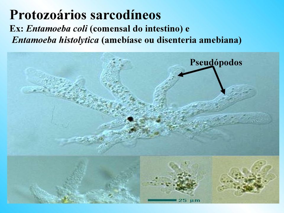 intestino) e Entamoeba histolytica