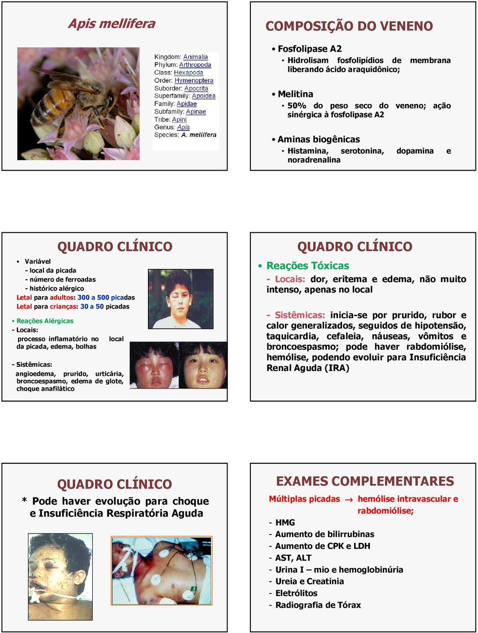 crianças: 30 a 50 picadas Reações Alérgicas - Locais: processo inflamatório no da picada, edema, bolhas local - Sistêmicas: angioedema, prurido, urticária, broncoespasmo, edema de glote, choque