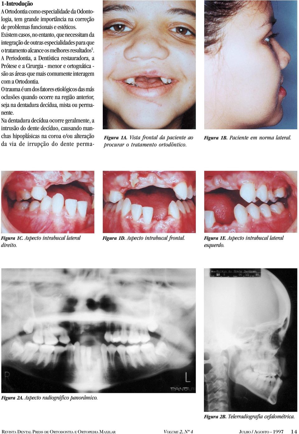 A Periodontia, a Dentística restauradora, a Prótese e a Cirurgia - menor e ortognática são as áreas que mais comumente interagem com a Ortodontia.