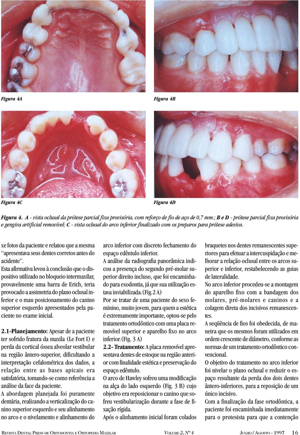 xe fotos da paciente e relatou que a mesma apresentava seus dentes corretos antes do acidente.