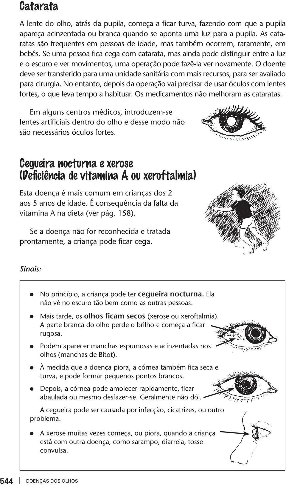 Se uma pessoa fica cega com caaraa, mas ainda pode disinguir enre a luz e o escuro e ver movimenos, uma operação pode fazê-la ver novamene.