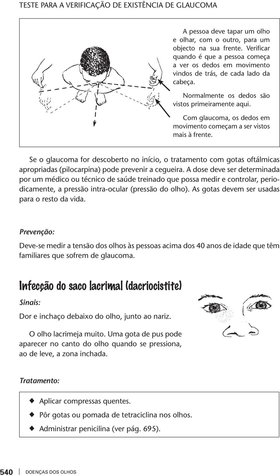 Com glaucoma, os dedos em movimeno começam a ser visos mais à frene. Se o glaucoma for descobero no início, o raameno com goas ofálmicas apropriadas (pilocarpina) pode prevenir a cegueira.