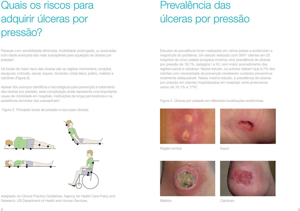 Os locais de maior risco das úlceras são as regiões mentoniana, occipital, escapular, cotovelo, sacral, ísqueo, trocanter, crista ilíaca, joelho, maléolo e calcâneo (Figura 3).