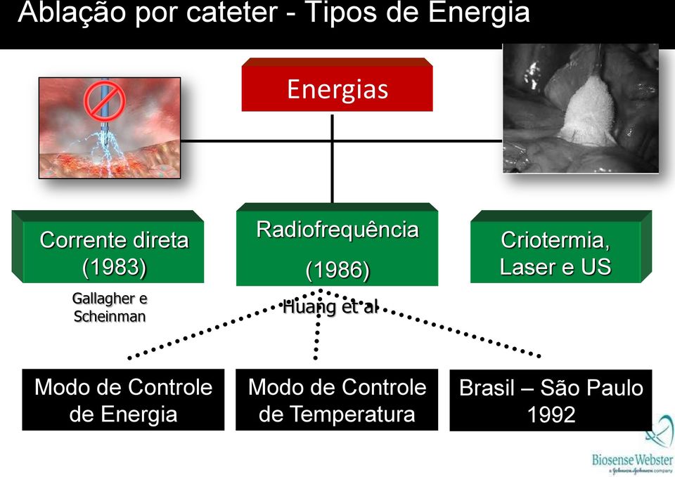 (1986) Huang et al Criotermia, Laser e US Modo de