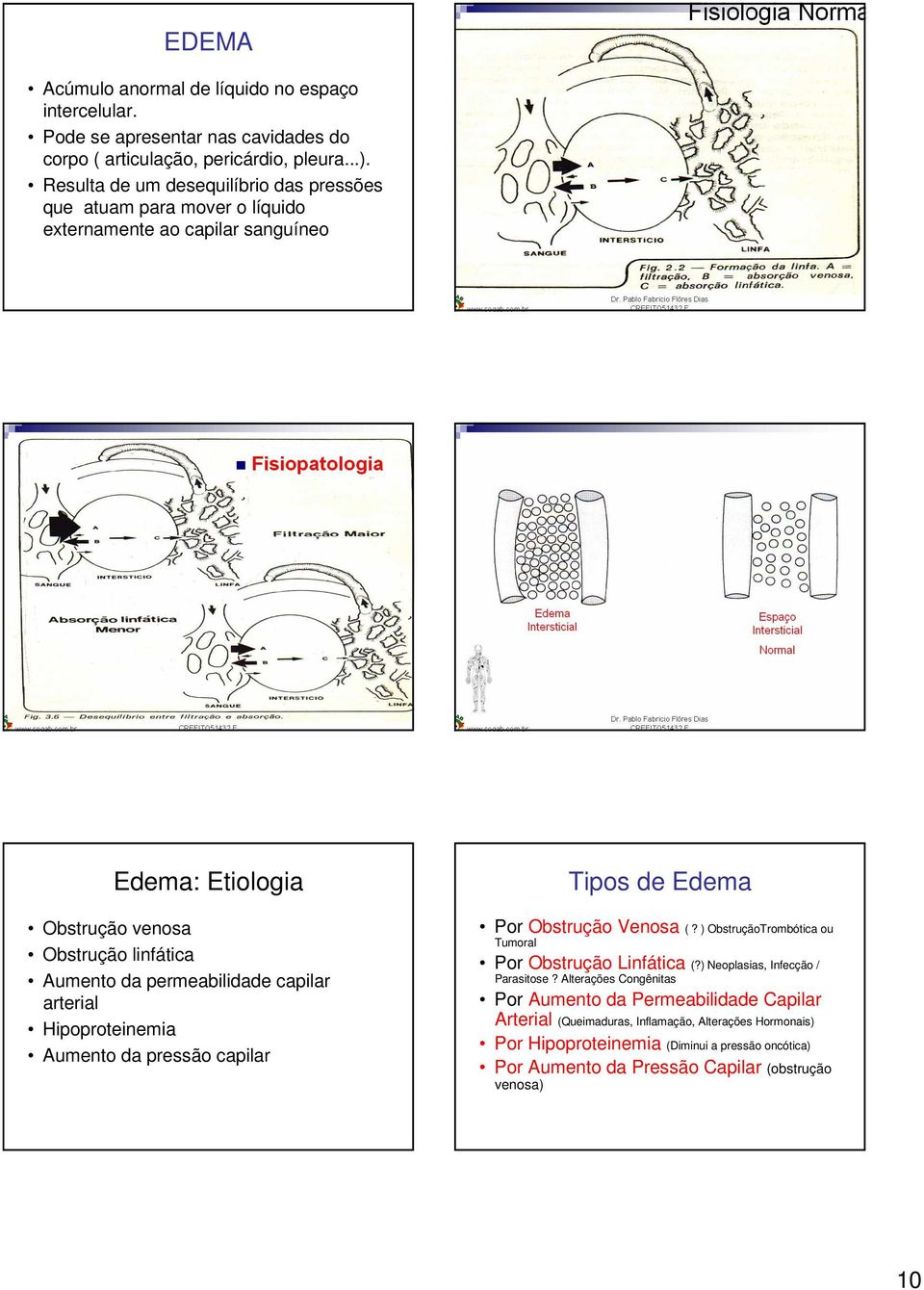 permeabilidade capilar arterial Hipoproteinemia Aumento da pressão capilar Tipos de Edema Por Obstrução Venosa (? ) ObstruçãoTrombótica ou Tumoral Por Obstrução Linfática (?