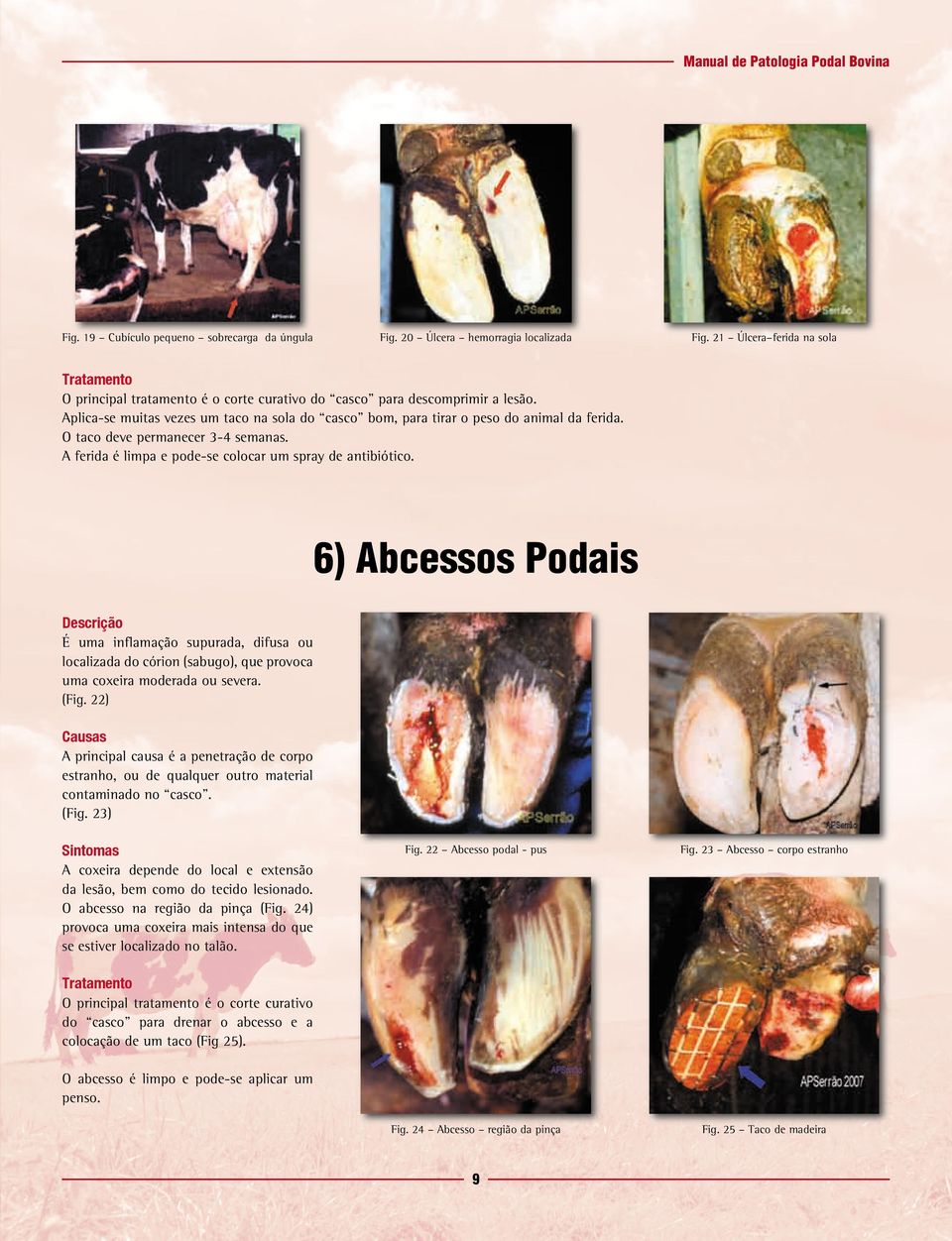 6) Abcessos Podais É uma inflamação supurada, difusa ou localizada do córion (sabugo), que provoca uma coxeira moderada ou severa. (Fig.