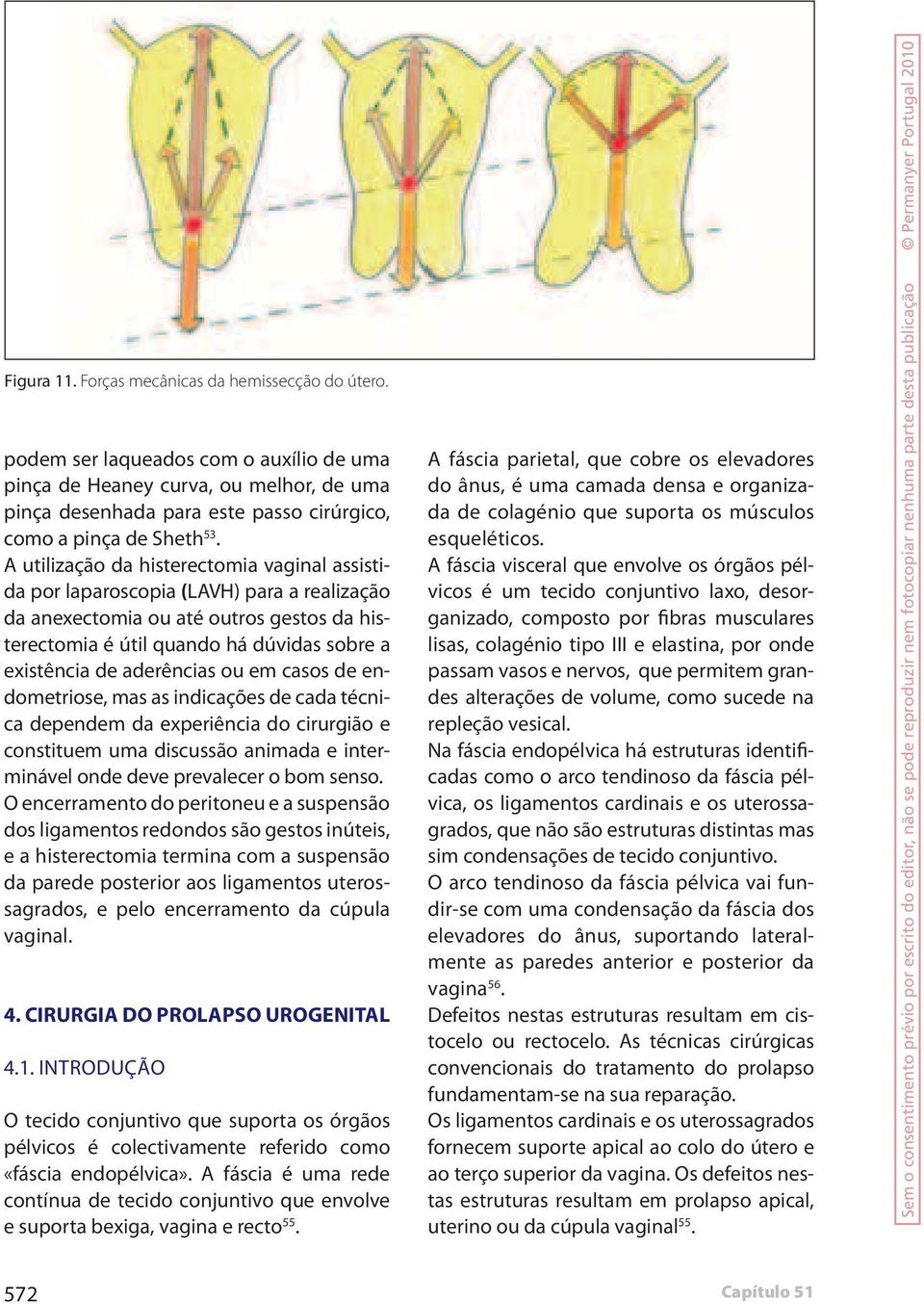 A utilização da histerectomia vaginal assistida por laparoscopia (LAVH) para a realização da anexectomia ou até outros gestos da histerectomia é útil quando há dúvidas sobre a existência de