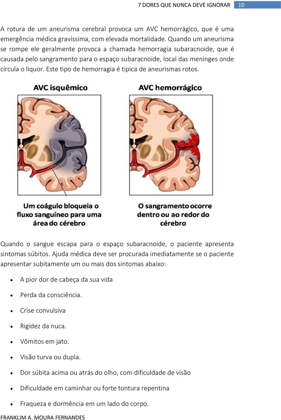 Este tipo de hemorragia é tipica de aneurismas rotos. Quando o sangue escapa para o espaço subaracnoide, o paciente apresenta sintomas súbitos.