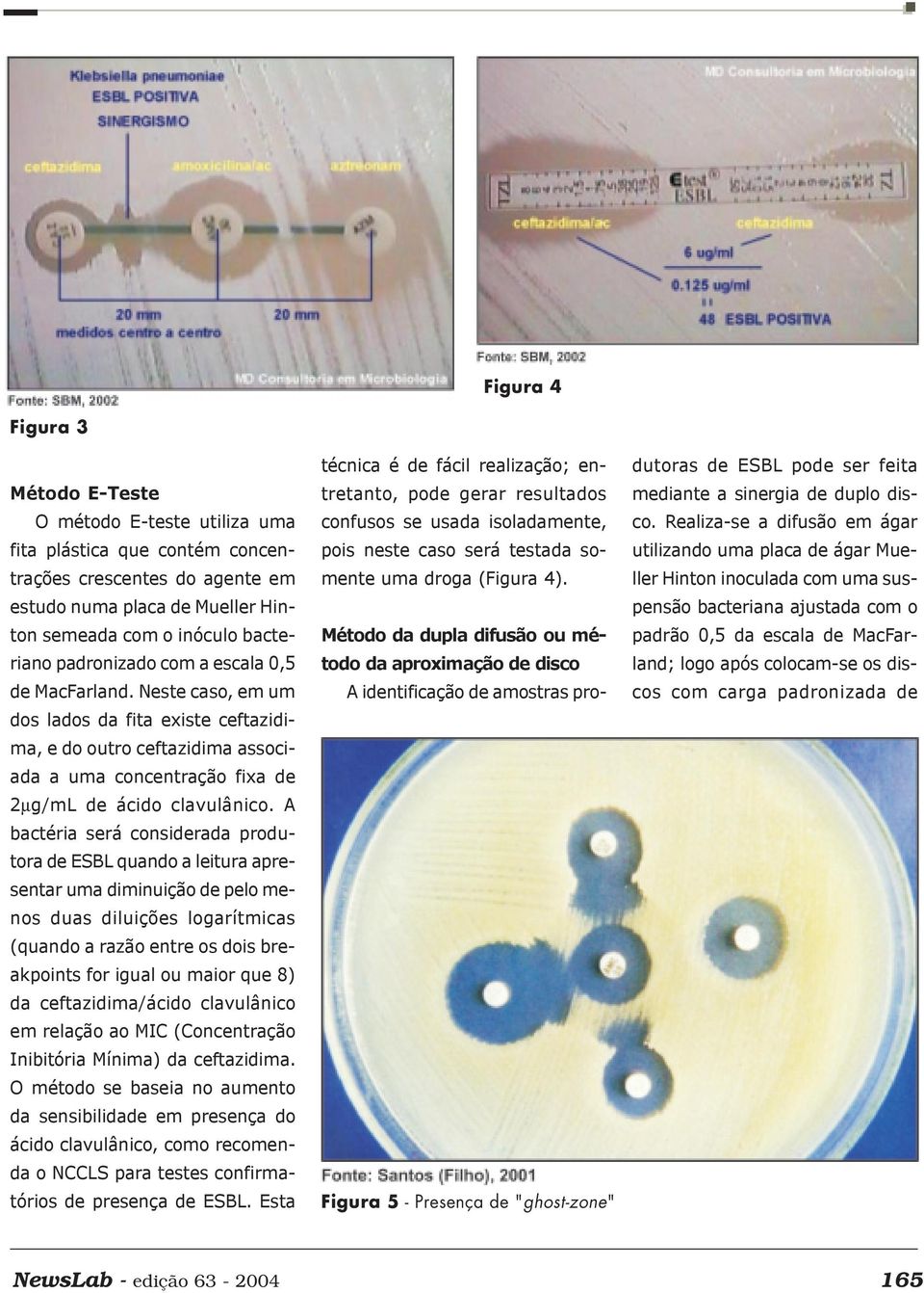 A bactéria será considerada produtora de ESBL quando a leitura apresentar uma diminuição de pelo menos duas diluições logarítmicas (quando a razão entre os dois breakpoints for igual ou maior que 8)