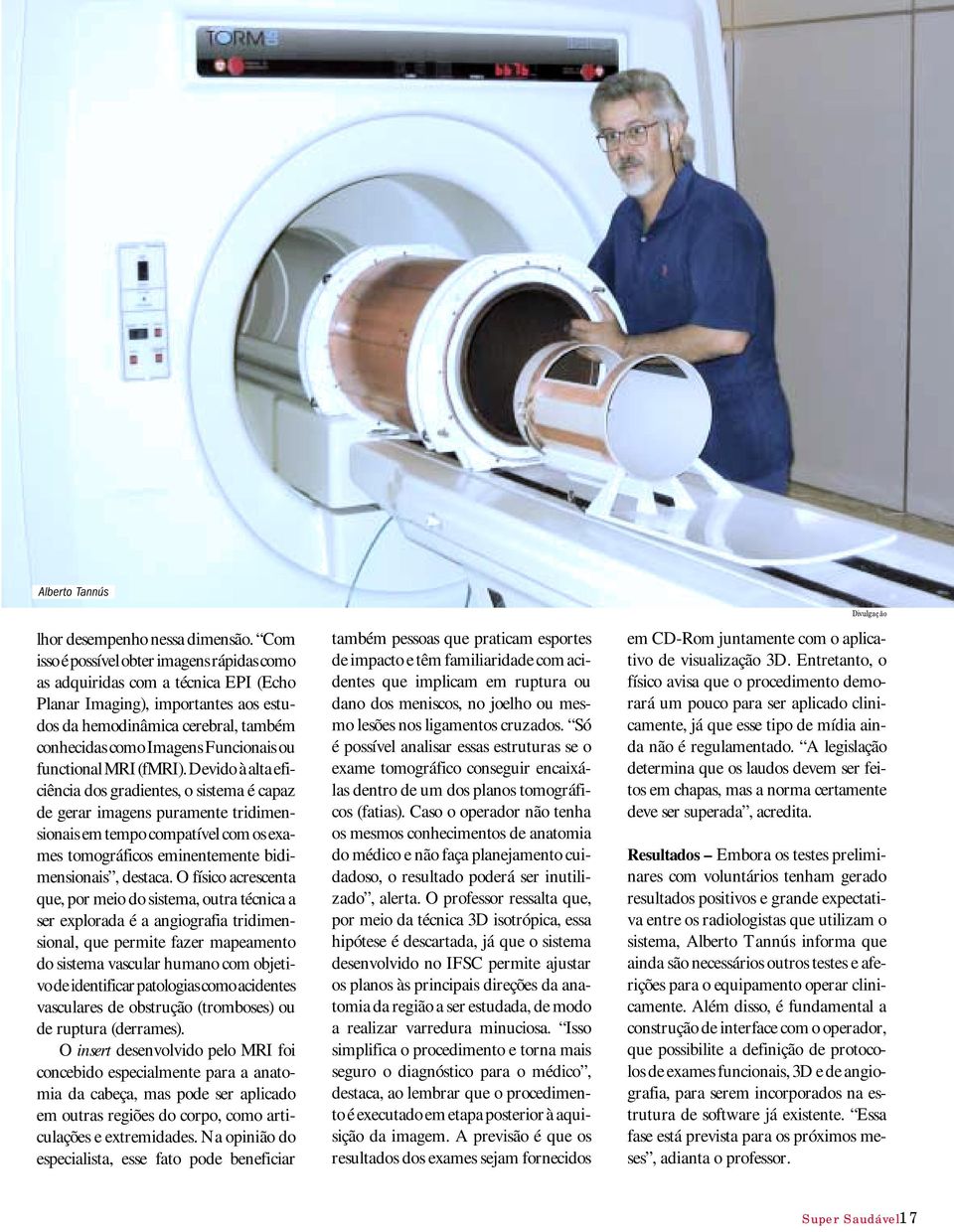 functional MRI (fmri).