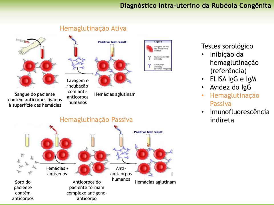 hemaglutinação (referência) ELISA IgG e IgM Avidez do IgG Hemaglutinação Passiva Imunofluorescência indireta Soro do paciente