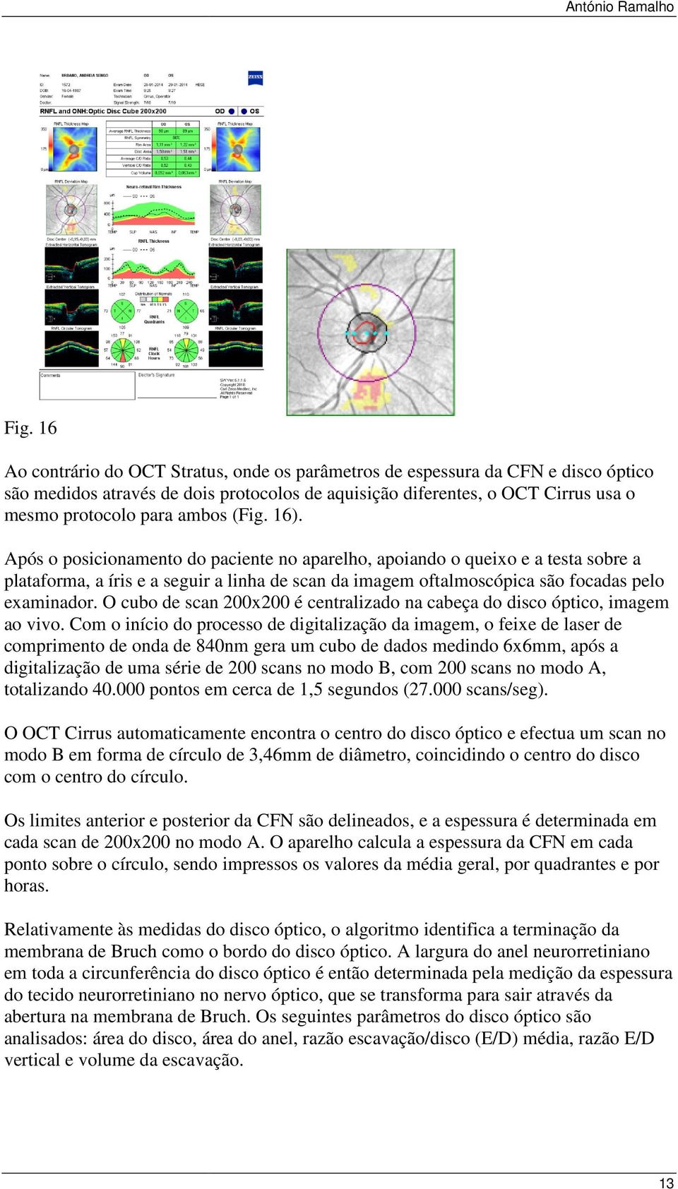 O cubo de scan 200x200 é centralizado na cabeça do disco óptico, imagem ao vivo.