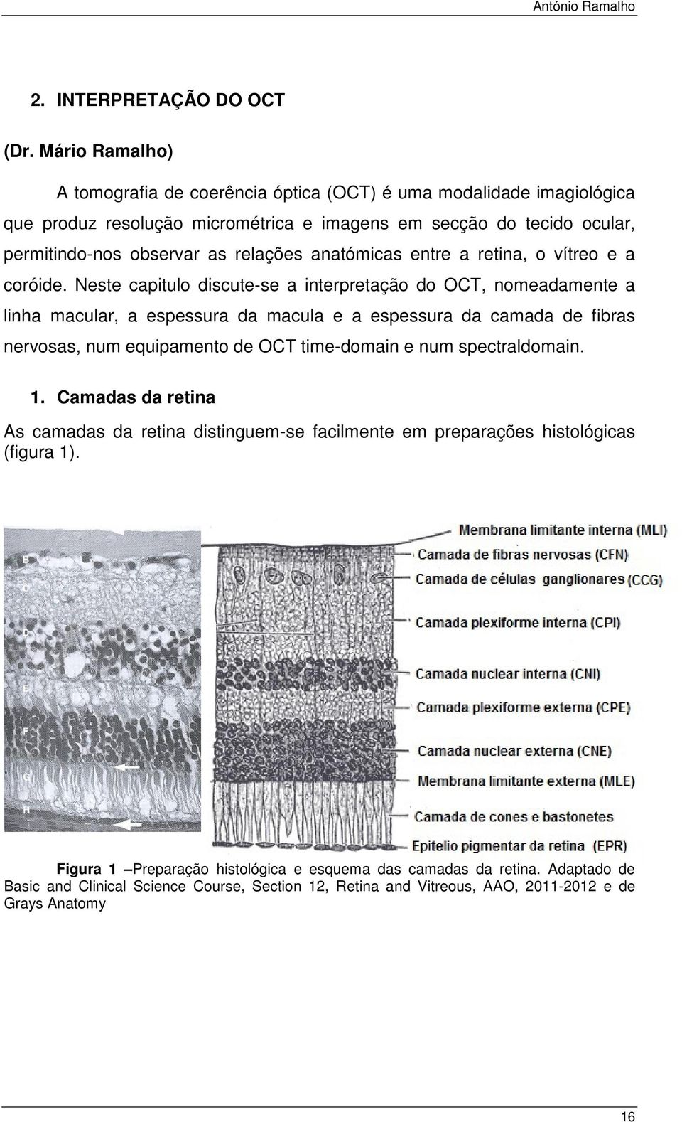 relações anatómicas entre a retina, o vítreo e a coróide.