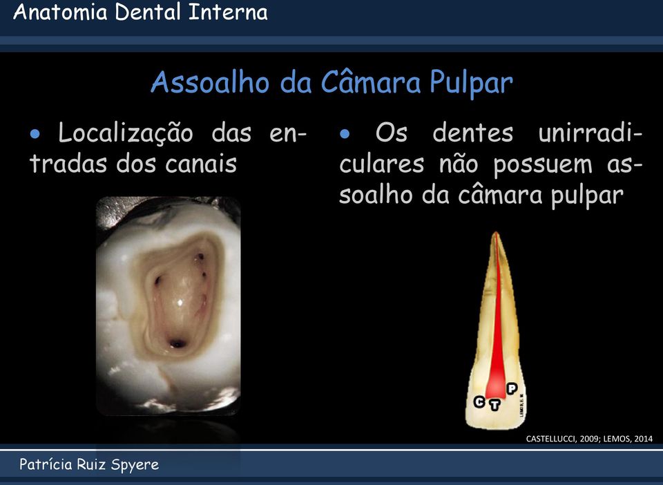 Os dentes unirradiculares não possuem