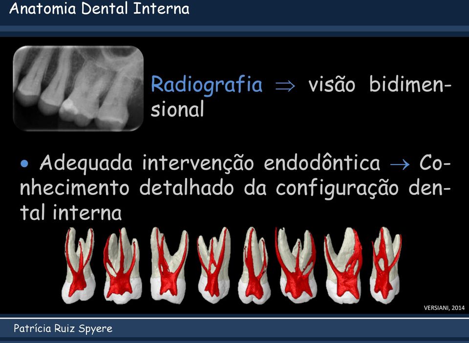 intervenção endodôntica Conhecimento