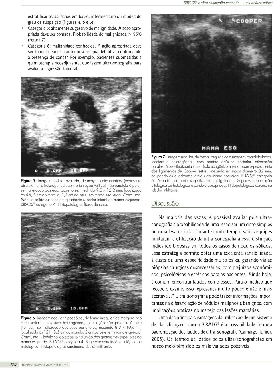 Por exemplo, pacientes submetidas a quimioterapia neoadjuvante, que fazem ultra-sonografia para avaliar a regressão tumoral.