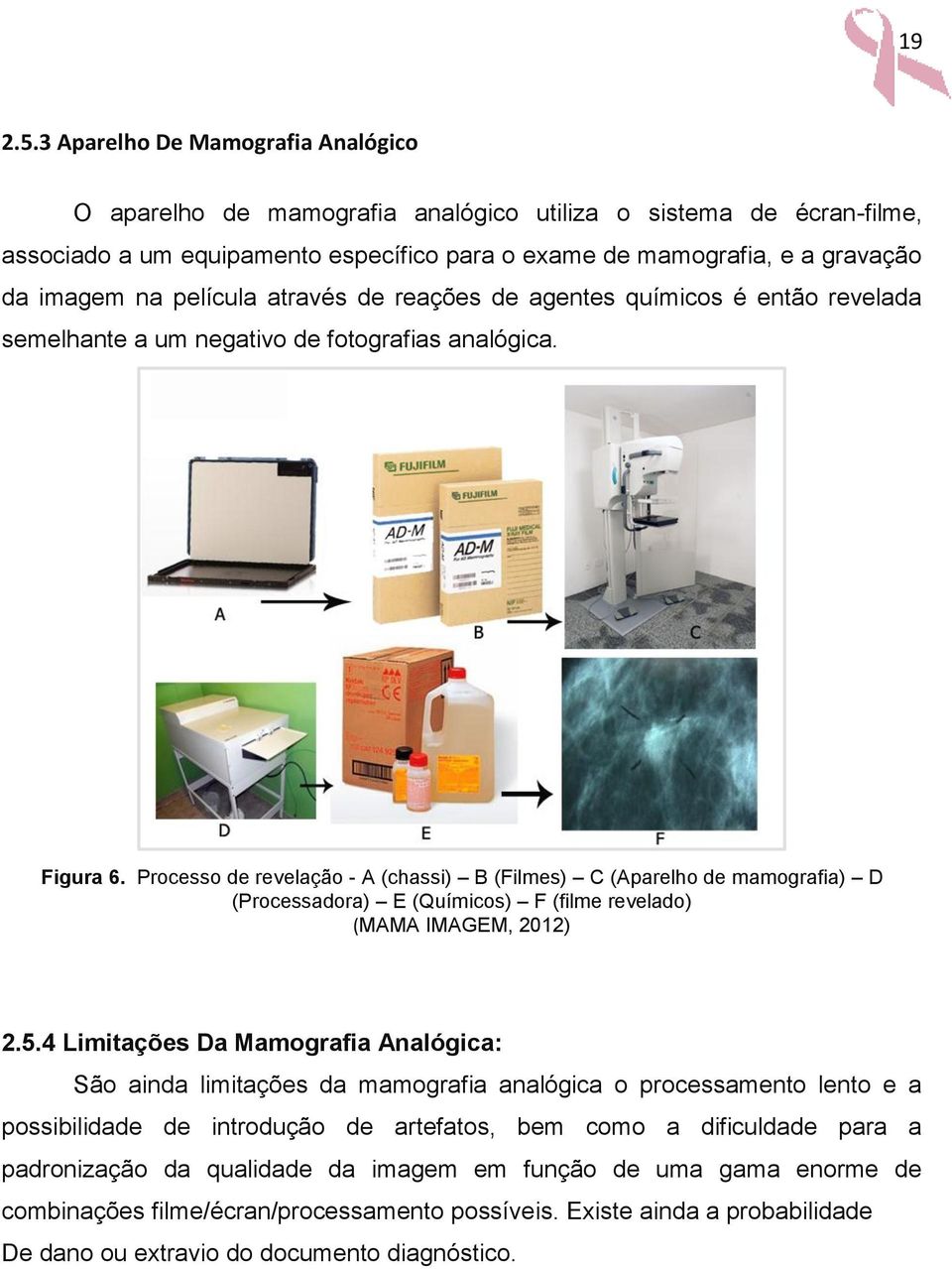 película através de reações de agentes químicos é então revelada semelhante a um negativo de fotografias analógica. Figura 6.