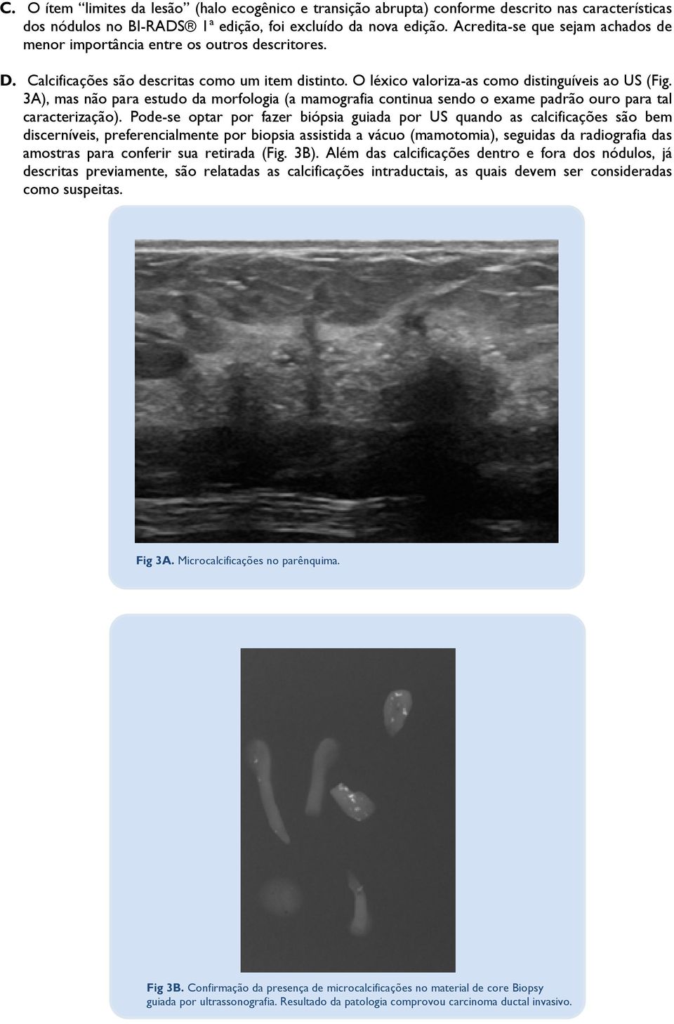 3A), mas não para estudo da morfologia (a mamografia continua sendo o exame padrão ouro para tal caracterização).