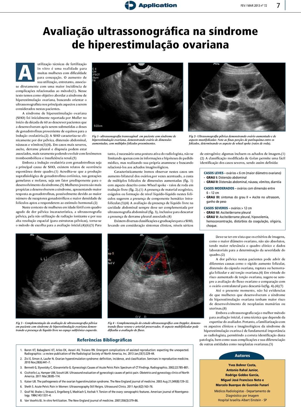 Nesse texto temos como objetivo abordar a síndrome de hiperestimulação ovariana, buscando orientar o ultrassonografista nos principais aspectos a serem considerados nestas pacientes.