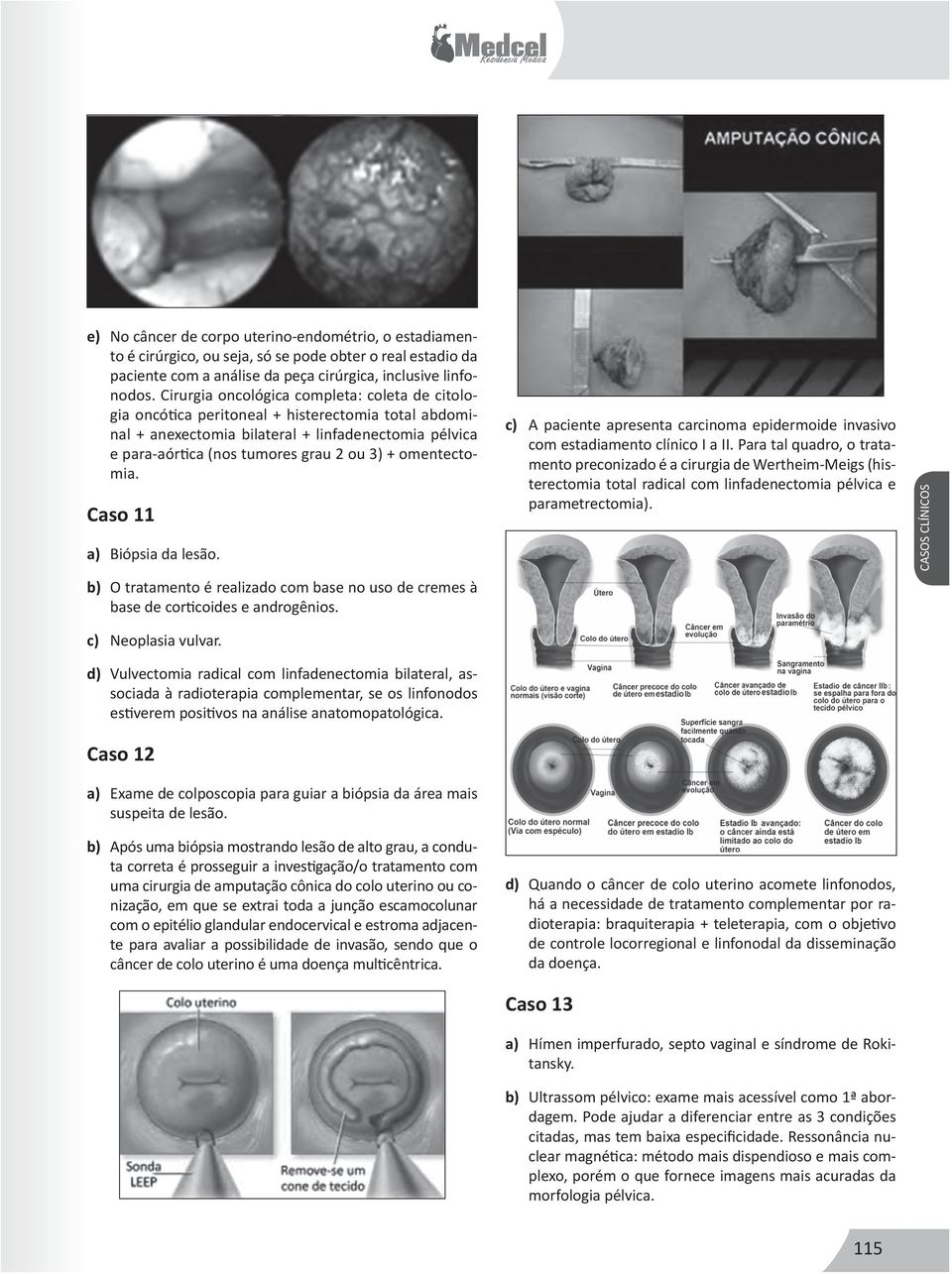 omentectomia. Caso 11 a) Biópsia da lesão. b) O tratamento é realizado com base no uso de cremes à base de corticoides e androgênios.