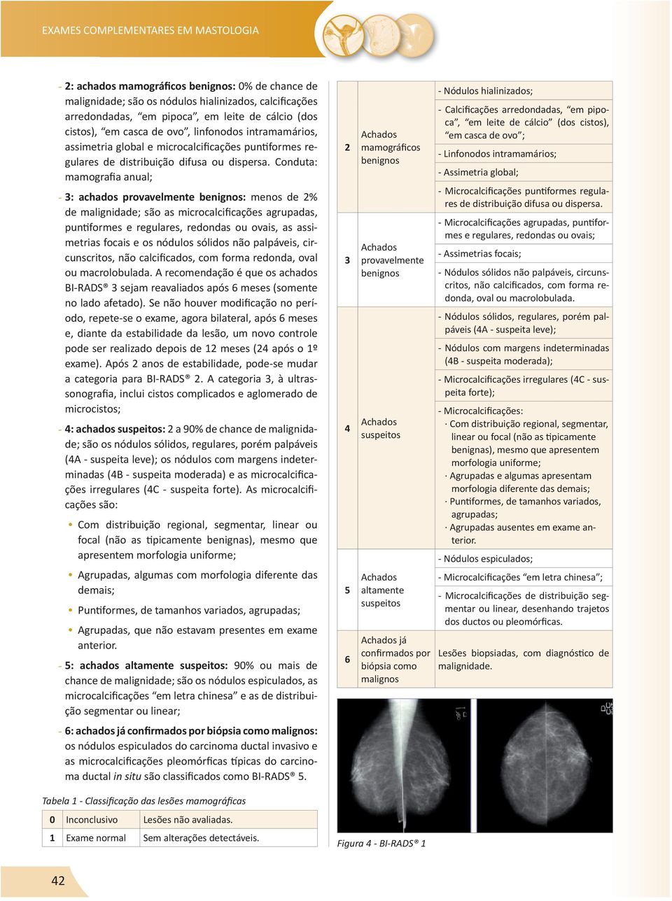 Conduta: mamografia anual; - 3: achados provavelmente benignos: menos de 2% de malignidade; são as microcalcificações agrupadas, puntiformes e regulares, redondas ou ovais, as assimetrias focais e os