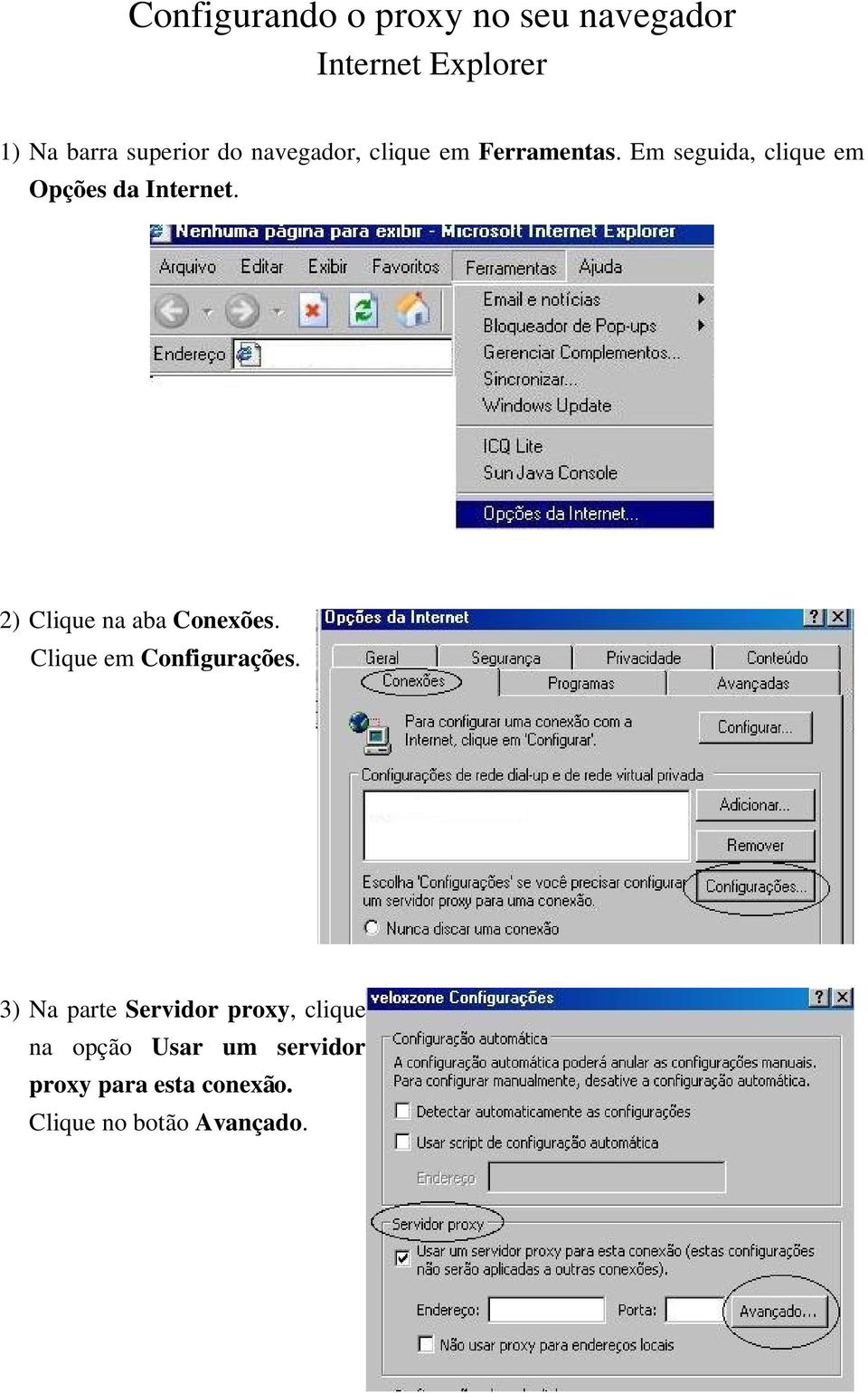 2) Clique na aba Conexões. Clique em Configurações.