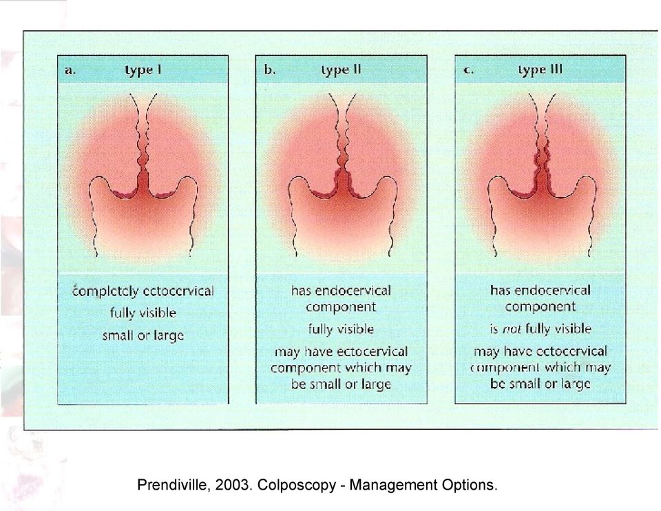 Colposcopy -