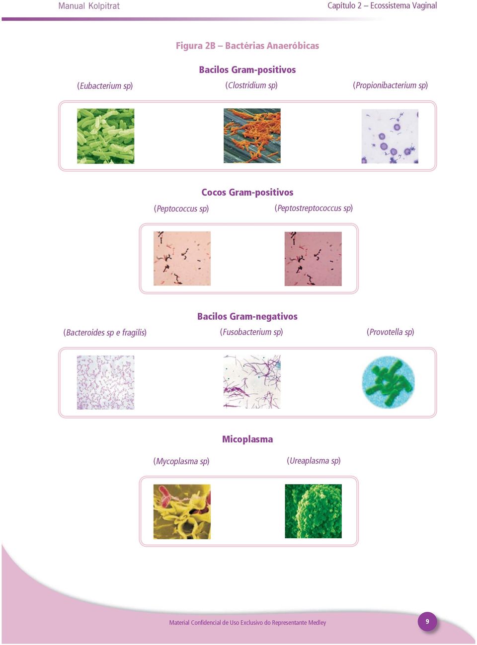 Cocos Gram-positivos (Peptostreptococcus sp) (Bacteroides sp e fragilis) Bacilos