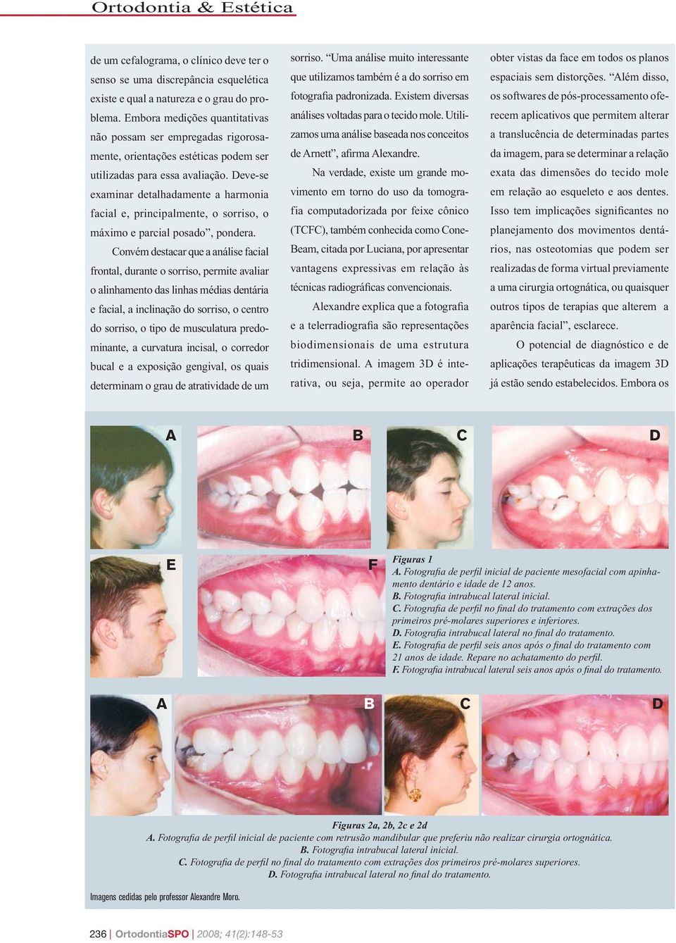 Deve-se examinar detalhadamente a harmonia facial e, principalmente, o sorriso, o máximo e parcial posado, pondera.