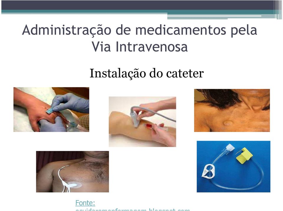 Intravenosa Instalação do