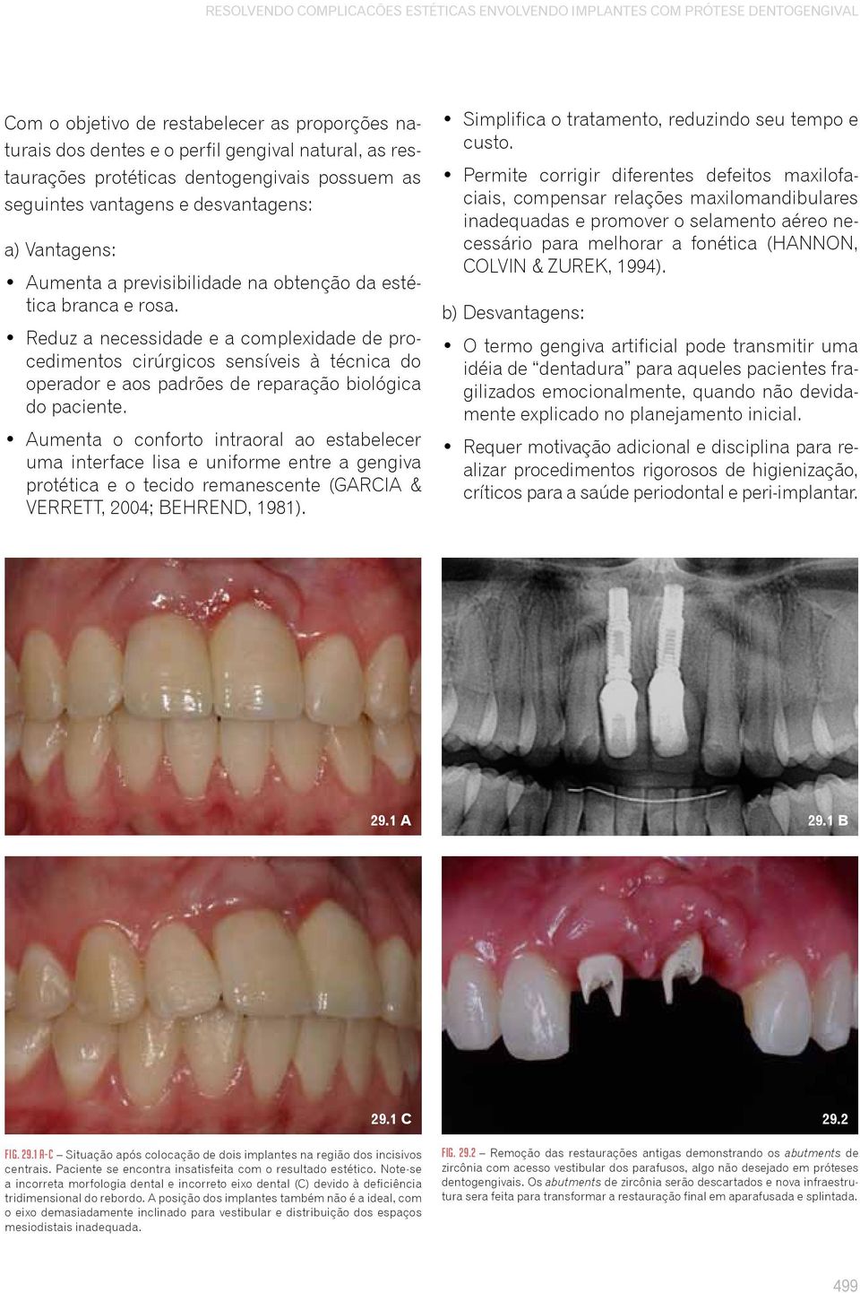 Reduz a necessidade e a complexidade de procedimentos cirúrgicos sensíveis à técnica do operador e aos padrões de reparação biológica do paciente.