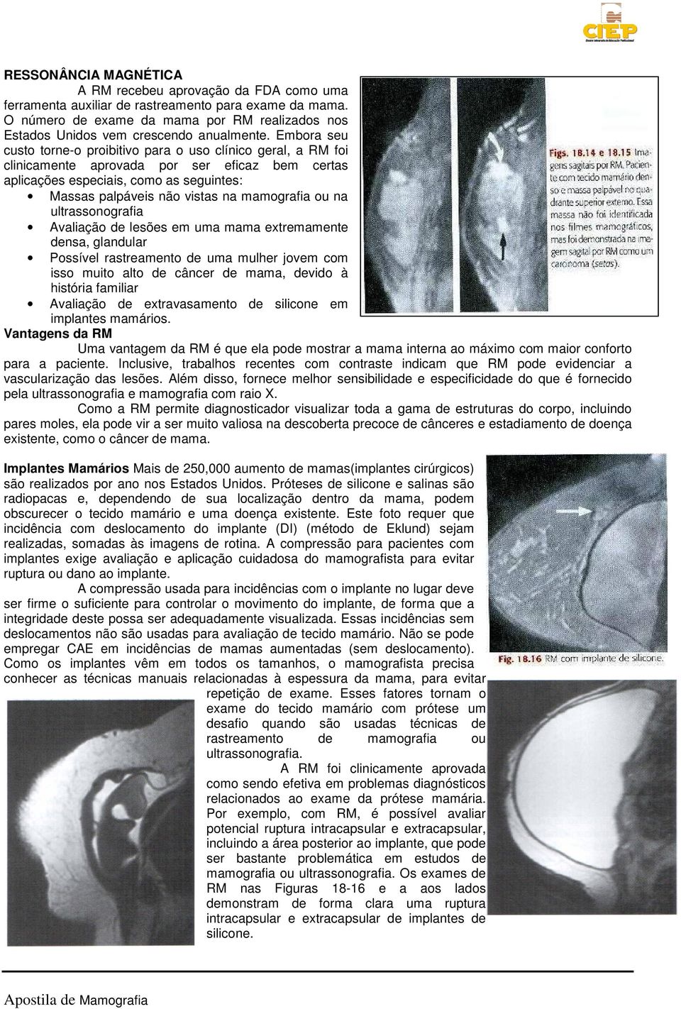 Embora seu custo torne-o proibitivo para o uso clínico geral, a RM foi clinicamente aprovada por ser eficaz bem certas aplicações especiais, como as seguintes: Massas palpáveis não vistas na