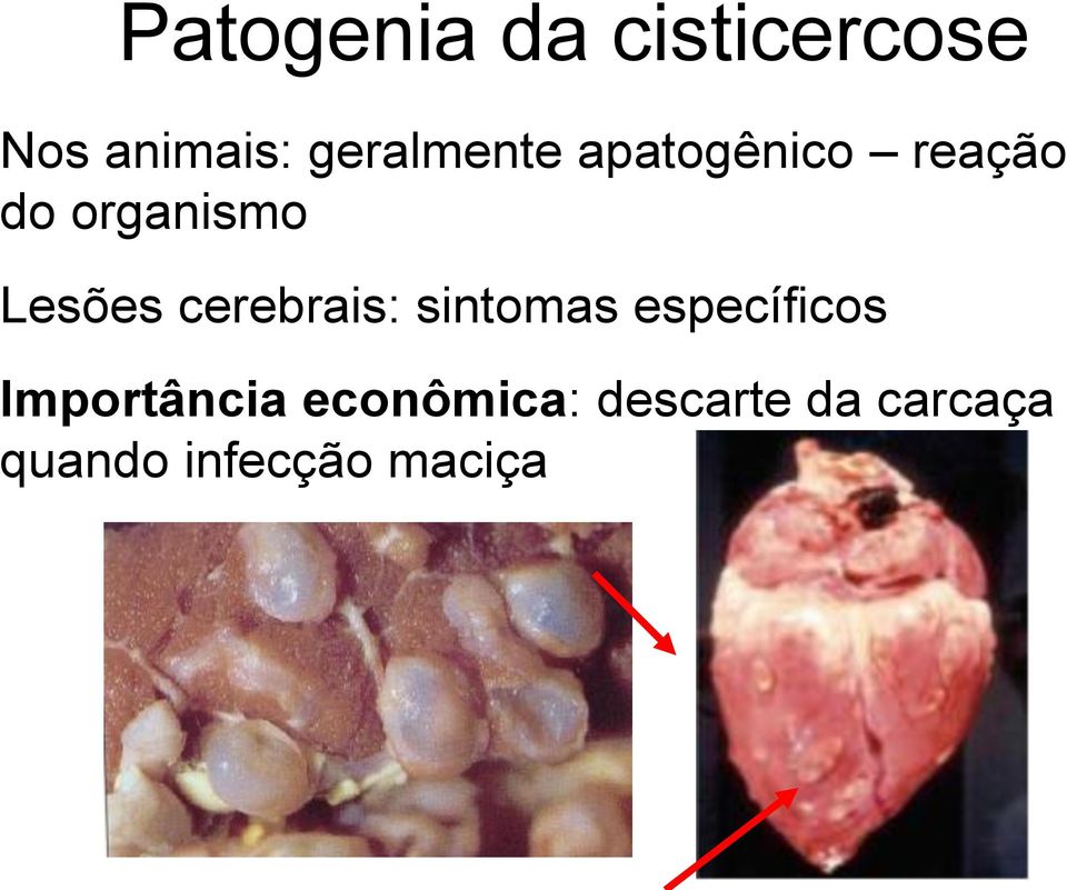 Lesões cerebrais: sintomas específicos