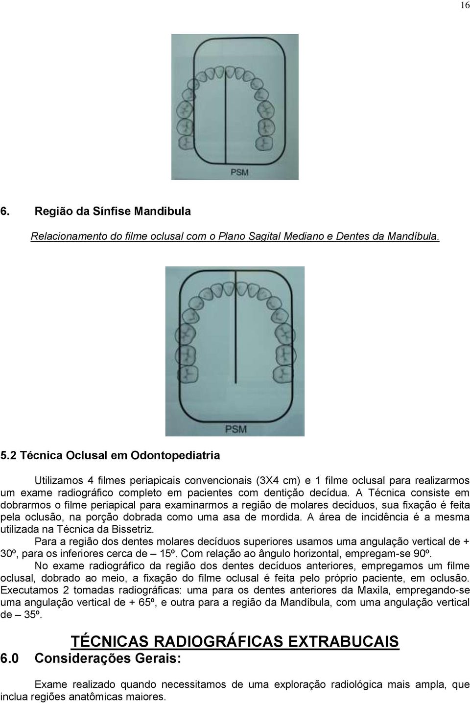 A Técnica consiste em dobrarmos o filme periapical para examinarmos a região de molares decíduos, sua fixação é feita pela oclusão, na porção dobrada como uma asa de mordida.