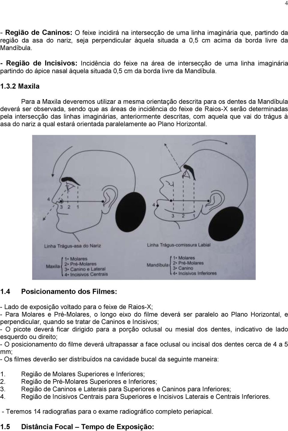 2 Maxila Para a Maxila deveremos utilizar a mesma orientação descrita para os dentes da Mandíbula deverá ser observada, sendo que as áreas de incidência do feixe de Raios-X serão determinadas pela