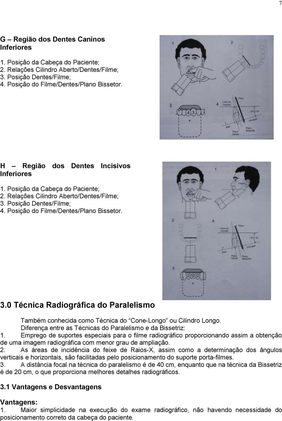 Posição Dentes/Filme; 4. Posição do Filme/Dentes/Plano Bissetor. 3.0 Técnica Radiográfica do Paralelismo Também conhecida como Técnica do Cone-Longo ou Cilindro Longo.