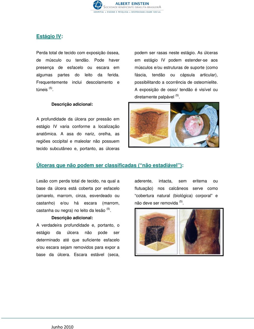 As úlceras em estágio IV podem estender-se aos músculos e/ou estruturas de suporte (como fáscia, tendão ou cápsula articular), possibilitando a ocorrência de osteomielite.