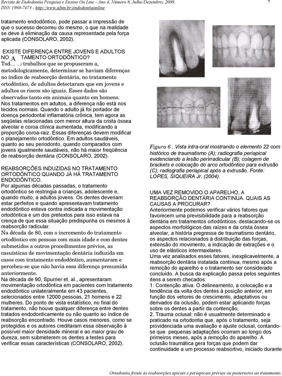 Na década de 80, com o incremento do tratamento ortodôntico em pessoas com mais idade e com dentes submetidos a outros procedimentos prévios, as