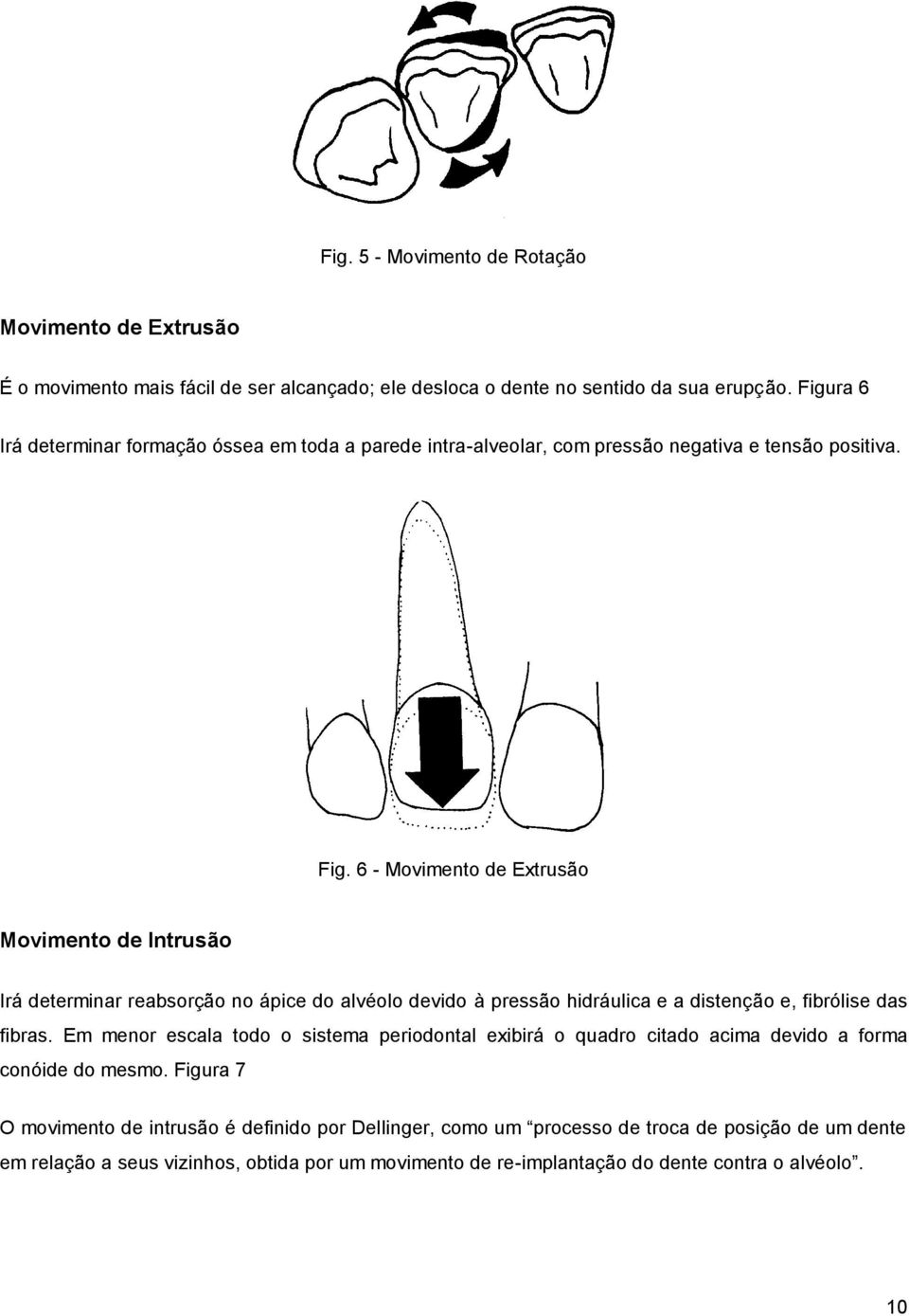 6 - Movimento de Extrusão Movimento de Intrusão Irá determinar reabsorção no ápice do alvéolo devido à pressão hidráulica e a distenção e, fibrólise das fibras.