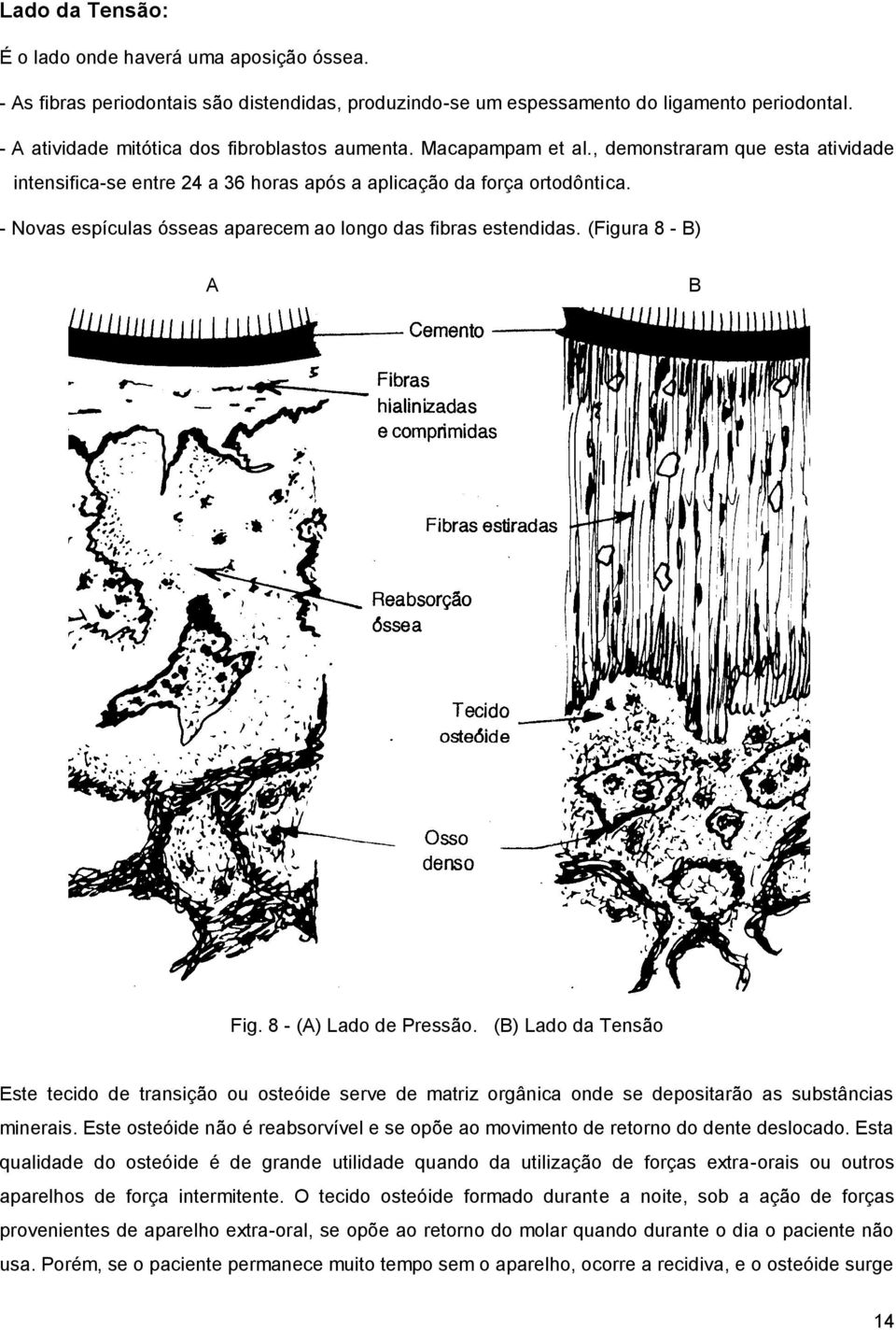 - Novas espículas ósseas aparecem ao longo das fibras estendidas. (Figura 8 - B) A B Fig. 8 - (A) Lado de Pressão.